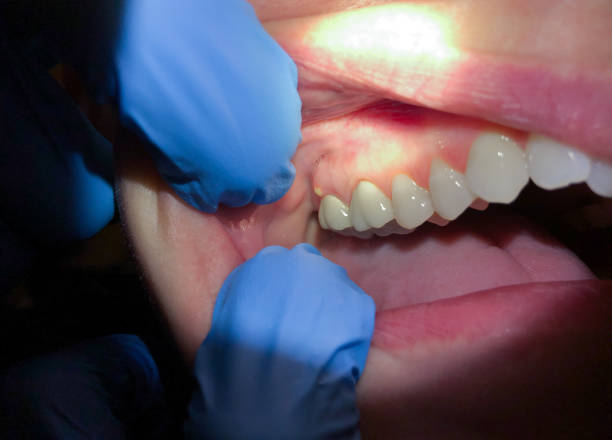 Best Emergency Root Canal Treatment in Raymond, MS