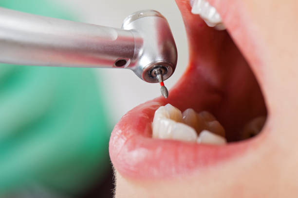 Best Emergency Dental Surgery in Raymond, MS